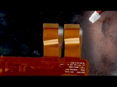 LCD 디스플레이 환자 모니터 터치 스크린