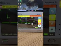 Mindray BeneView T1 환자 모니터 LCD 화면(전면 커버 포함)을 선택하는 이유를 확인하세요.