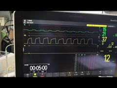 Mindray AG 모듈 AG 및 O2 모듈 MMS 모듈 PN 115-023943-00 데모 보기