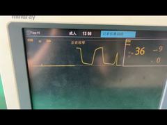 자세히 살펴보기: 9200-10-10530 성인 소아 마취 가스 모듈용 Mindray 워터 트랩